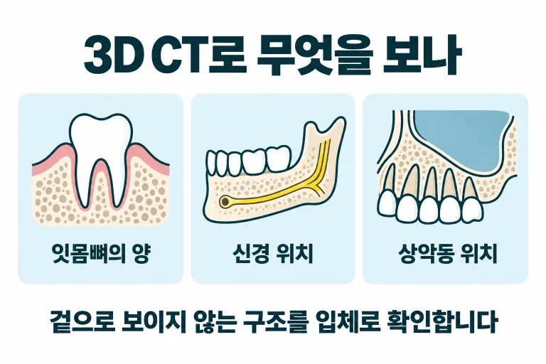동탄에서 치과 3D CT를 왜 찍는지, 무엇을 보려고 촬영하는지 정리했습니다. 뼈·신경·상악동을 입체로 확인해 임플란트를 계획하는 데 활용합니다