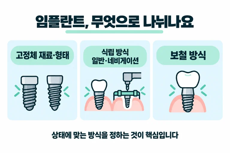 임플란트를 나누는 기준을 정리한 안내도