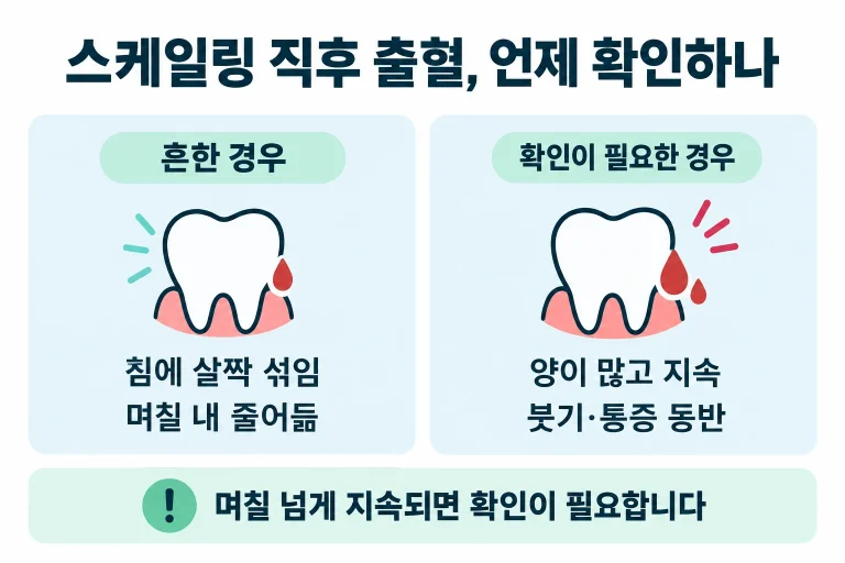 동탄에서 스케일링 직후 피가 조금 나면 대부분 잇몸 염증이 있던 신호입니다. 왜 그런지, 언제 확인이 필요한지 치주과 전문의 관점에서 정리했습니