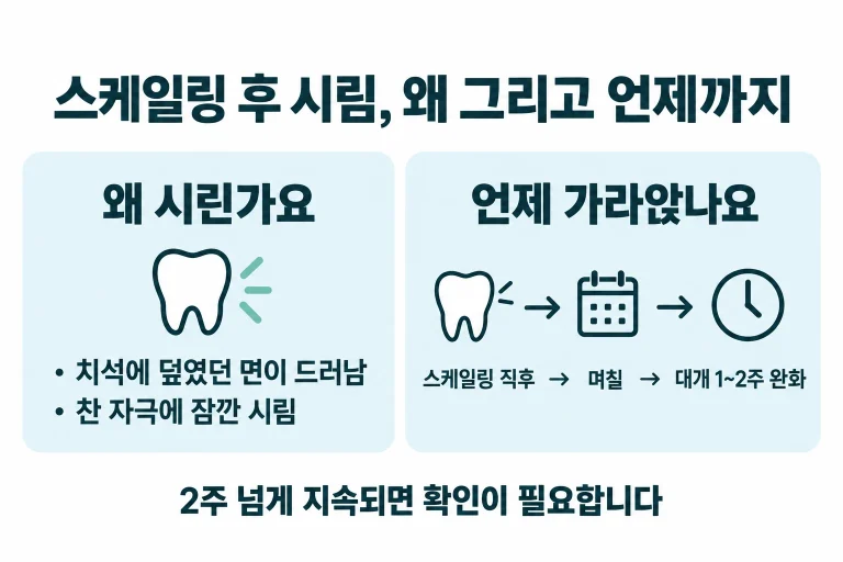 스케일링 후 이가 시린 이유와 지나가는 기간을 정리한 안내도